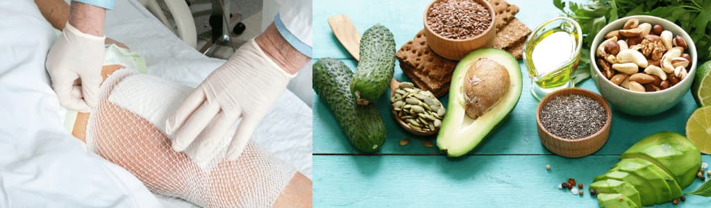 nutrition and wound healing
