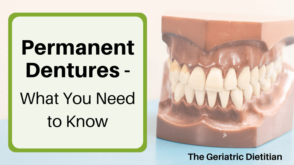 Permanent Dentures What You Need to Know Featured Image