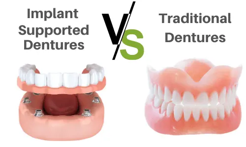 implant supported dentures vs traditional dentures