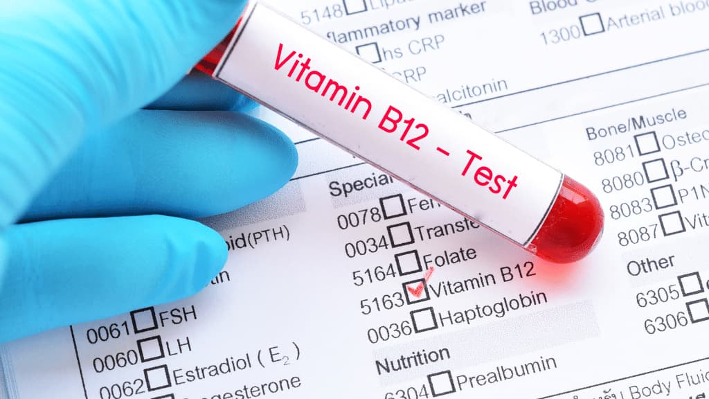 Vitamin B12 Deficiency Blood Test.